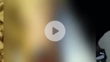 साहेबपुर कमाल: रघुनाथपुर में लेन-देन के विवाद में महिला को मारी गोली, पैर में लगी गंभीर चोट