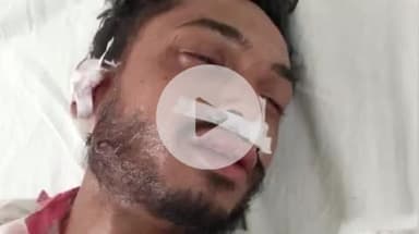 गुमला: सड़क दुर्घटना में घायल अज्ञात युवक सदर अस्पताल में भर्ती