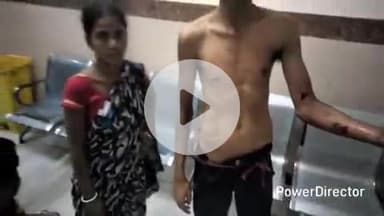 कटिहार: हरिगंज चौक पर दो पक्षों में मारपीट, एक व्यक्ति घायल, अस्पताल में भर्ती