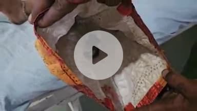 लाडपुरा: तालेड़ा थाना इलाके के रामपुरिया गांव में सांप पर पैर रखने पर सांप ने काटा, परिजन सांप को मारकर अस्पताल लाए