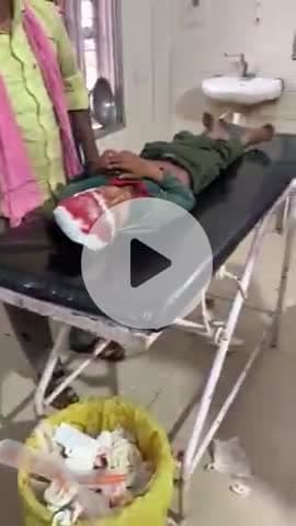 जतारा: गररौली गांव में जामुन के पेड़ से गिरा 5 वर्षीय बच्चा, गंभीर हालत में झांसी किया गया रेफर