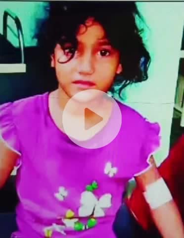 घाटमपुर: मगरासा गांव में कटखने बंदर का आतंक, दो दर्जन से ज्यादा मासूमों और ग्रामीणों को बनाया शिकार