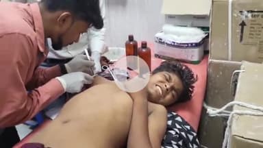 जहानाबाद: ताड़ का फ़ेदा काटते समय बालक गंभीर रूप से घायल, काटी अपनी बांह, मां का रो-रो कर बुरा हाल