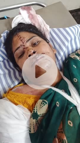 वैर: ईको और कार की भिड़ंत में वैर के आधा दर्जन लोग हुए घायल, सभी जॉबनेर से दर्शन कर लौट रहे थे