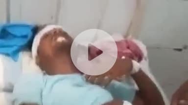 पूर्णिया पूर्व: रानीपरता में ग्यारह हजार हाईटेंशन तार की चपेट में आया मजदूर, अस्पताल में भर्ती