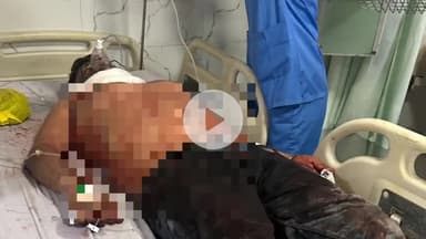 अमरोहा: गांव औरंगाबाद में जान से मारने की नीयत से चाकू से काटा गला, हालत गंभीर, मुकदमा दर्ज