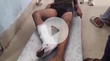 गोपालगंज: शहर के वीएम फील्ड में होमगार्ड बहाली के दौरान युवक का पैर टूटा, सदर अस्पताल में भर्ती, वर्दी पहनने का सपना टूटा