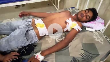 बेतिया: बसंतपुर स्कूल परिसर में इंटर के छात्र को चाकू मारकर किया घायल, जीएमसीएच में भर्ती