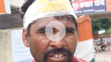 साहेबपुर कमाल: सलेमा दियारा में एक व्यक्ति के साथ मारपीट की घटना