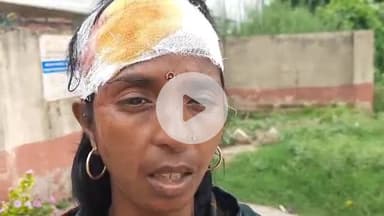 साहेबपुर कमाल: सलेमाबाद में एक महिला के साथ मारपीट, सिर फोड़ा