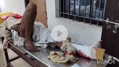 सासाराम: NH पर रोड एक्सीडेंट में एक व्यक्ति गंभीर रूप से जख्मी हुआ