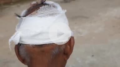 बलिया: बड़ी बलिया उत्तरी में एक व्यक्ति के सिर पर ईंट से हमला, सिर फोड़ा