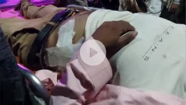 खरगौन: ₹200 के लेनदेन में मजदूर ने ठेकेदार को मारा चाकू, 3 इंच गहरा घाव, खरगोन से इंदौर रेफर