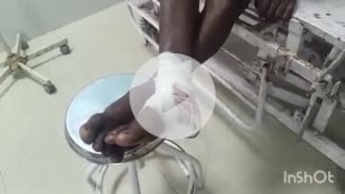 आरा: बिहिया चौरस्ता के समीप ट्रक के चकमें से बाइक सवार घायल, आरा सदर अस्पताल में कराया गया भर्ती