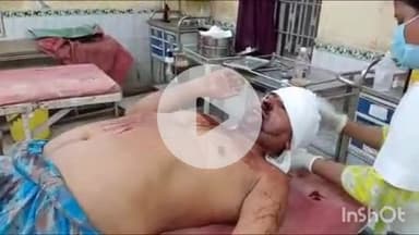 गोपालगंज: तकिया बनकट गांव में छोटे भाई ने बड़े भाई को छत से फेंका, हालत गंभीर