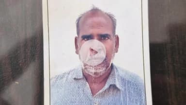 झांसी: झांसी के भोजला गांव में सांप के काटने से एक व्यक्ति की मौत, 6 घंटे तक झाड़-फूंक और देसी इलाज कराते रहे