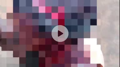 सिंगरौली: डिगवाह के जंगल में डोरी बीनने गए व्यक्ति पर भालुओं का हमला, गंभीर हालत में अस्पताल में भर्ती