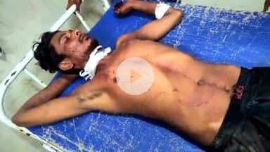 बेतिया: नौरंगाबाद डोमटोली में पारिवारिक कलह में युवक ने काटा गला, जीएमसीएच में भर्ती, इलाज जारी