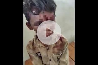 बलरामपुर: लखाही गांव में 7 साल के मासूम को शौचालय में बंद कर युवकों ने बेरहमी से पीटा, गंभीर हालत में अस्पताल में भर्ती