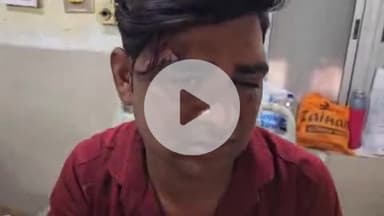 पीपलदा: स्टेट हाइवे 70 पर गणेशगंज के निकट मोटरसाइकिल फिसलने से युवक घायल, MBS अस्पताल में भर्ती, उपचार जारी