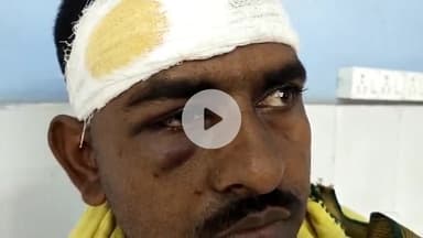 ताजपुर: मरीचा गांव में आम तोड़ने के विवाद में बड़े भाई ने छोटे भाई के साथ की मारपीट