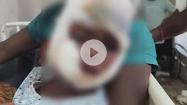 लोहरदगा: झाल झामुरा दीपा टोली के पास बाइक से गिरने से पिता-पुत्री घायल, अस्पताल में भर्ती