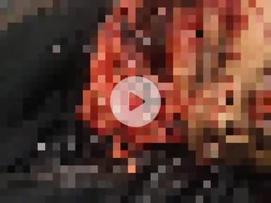 नौगावां सादात: नौगांवा अमरोहा रोड पर तेज रफ्तार बाइक सवार युवक की बाइक फिसली, हालत गंभीर