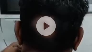 सहजनवा: नौसड़ चौकी क्षेत्र के हदिया गांव में स्कूटी से घर लौट रहे युवक को बदमाशों ने पीठ में मारी गोली