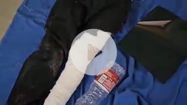 पीपलदा: स्टेट हाइवे 70 पर दौलतपुरा पुलिया के पास मोटरसाइकिल फिसलकर दुर्घटनाग्रस्त, गंभीर घायल एमबीएस अस्पताल में भर्ती