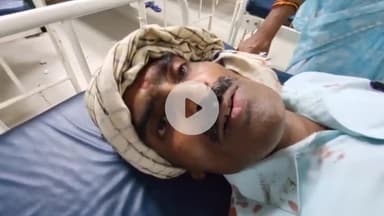 जहानाबाद: राजा बाजार रेलवे अंडरपास के पास बदमाशों ने मॉल से लौट रहे व्यक्ति पर किया जानलेवा हमला