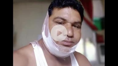 मंझनपुर: अहिरन के पुरवा में प्रधानपति पर जानलेवा हमला, एक अन्य युवक भी गंभीर घायल, घर जाते समय घेरकर किया वार