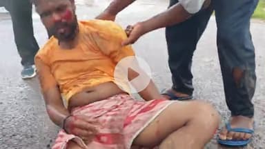 लोहरदगा: लोहरदगा-किस्को सड़क पर नशे में धुत दो युवक गिरे, एक की हालत गंभीर