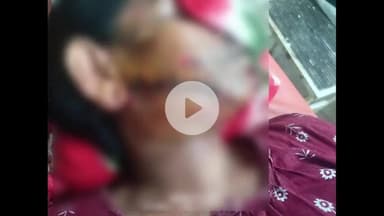 लोहरदगा: छोट चोरगांई में हैरान करने वाली घटना, दो भाइयों की लड़ाई में दंपति पर जानलेवा हमला