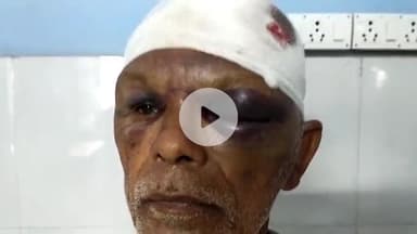 ताजपुर: खैरा गांव में जमीनी विवाद को लेकर एक व्यक्ति के साथ मारपीट