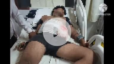 खुरई: रजवास रोड पर ढाबे में नमक की डिब्बी उठाने पर विवाद, युवक ने दूसरे को मारा चाकू