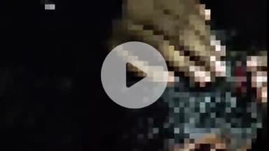 भोरे: कल्याणपुर गोईता टोला गांव में युवक पर चाकू से हमला, हमलावर फरार, मामला दर्ज