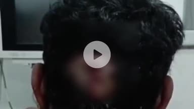 सहजनवा: नौसड़ इलाके के हरदिया गांव के पास दुकान से घर लौट रहे युवक को गोली मारने वाले 2 आरोपियों को पुलिस ने किया गिरफ्तार