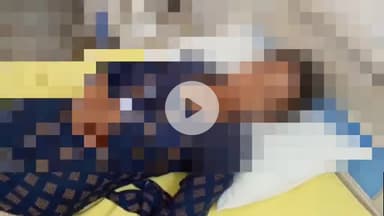 बरेली: सुभाष नगर थाना क्षेत्र की किशोरी ने भाई से झगड़े के बाद खा लिया जहरीला पदार्थ, जिला अस्पताल में भर्ती