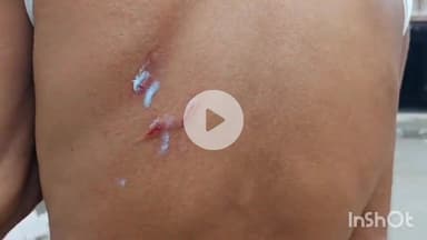 मेड़ता: पादू कला में बंदरों के आतंक से छत पर जाना लोगों के लिए हुआ मुश्किल