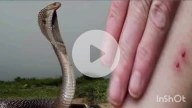 कोल: अलीगढ़ में बरसात के कारण सर्पदंश के मामलों में हुआ इज़ाफा, एक महीने में 19 लोग हुए सर्पदंश का शिकार, 3 की मौत