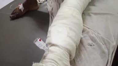 लाडपुरा: कोटा के रामपुरा थाना क्षेत्र में पुरानी रंजिश के चलते युवक पर धारदार हथियारों से हमला, युवक का अस्पताल में उपचार जारी