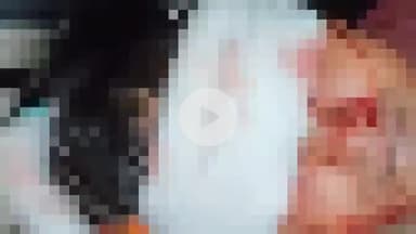 नौगावां सादात: नौगांवा अमरोहा रोड पर अज्ञात वाहन की टक्कर से बाइक सवार घायल, हालत गंभीर