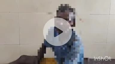 बहराइच: गुलामअलीपूरा में मामूली विवाद पर जमकर हुई मारपीट, घायल व्यक्ति ने भाई की पत्नी, बेटे और साले पर लगाया आरोप