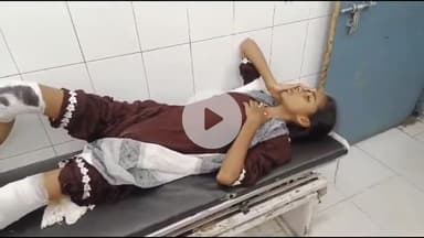 धनौरा: गजरौला हाईवे पर झनकपुरी के पास तेज रफ्तार कार ने बाइक को मारी टक्कर, 3 लोग हुए घायल