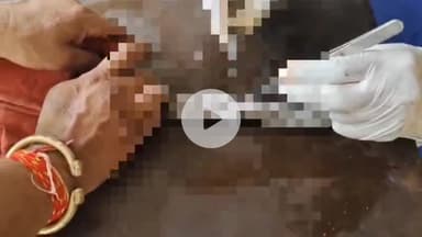 अजमेर: शास्त्री नगर में 8 फीट के जहरीले कोबरा सांप की सर्जरी, इंसानों की सर्जरी से है अलग