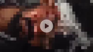 नौगावां सादात: नौगांवा बीलना नहर के पास अज्ञात वाहन की टक्कर से बाइक सवार गंभीर घायल