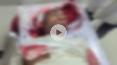 उदवंत नगर: जयनगर गांव के समीप अज्ञात वाहन की टक्कर से मोटरसाइकिल सवार युवक गंभीर रूप से जख्मी, हालत नाजुक