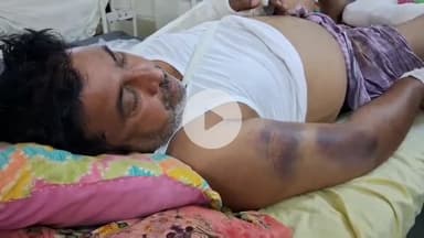 चूरू: चैनपुरा छोटा टोल नाका पर लूट के इरादे से एक युवक के साथ की गई मारपीट, जिला अस्पताल में इलाज जारी