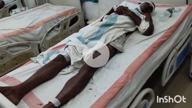 सासाराम: चितवनपुर में जमीनी विवाद को लेकर दो पक्षों में हुई मारपीट, एक व्यक्ति घायल