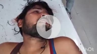 कोल: मदीना कोलोनी में घर में हुई कहासुनी के दौरान पड़ोसी ने की दखलंदाजी, झगड़े में दो भाइयों को छुरी मारकर किया घायल